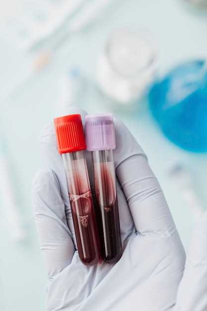 Риски использования донорской крови